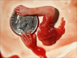 Медикаментозный аборт: аборт без операции